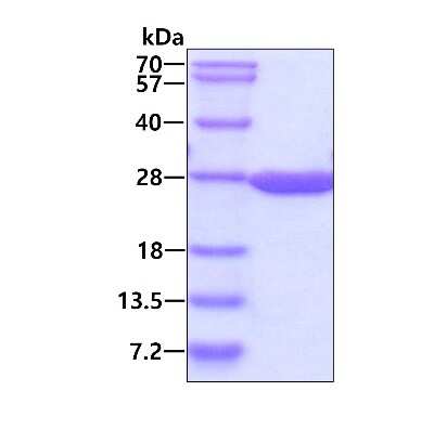 SDS-Page: Recombinant Mouse Dihydrofolate Reductase/DHFR His Protein [NBP1-72281] - 3ug by SDS-PAGE under reducing condition and visualized by coomassie blue stain.